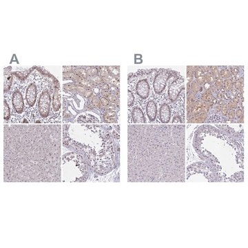 Anti-RBL1 antibody produced in rabbit Prestige Antibodies&#174; Powered by Atlas Antibodies, affinity isolated antibody, buffered aqueous glycerol solution