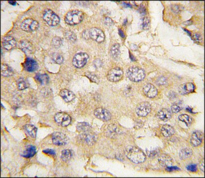 Anti-PARG (N-term) antibody produced in rabbit saturated ammonium sulfate (SAS) precipitated, buffered aqueous solution