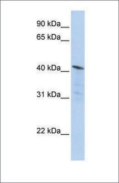 Anti-HDAC11 antibody produced in rabbit affinity isolated antibody