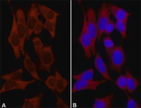 Anti-NQO1 (extrémité C-terminale) antibody produced in rabbit ~1&#160;mg/mL, affinity isolated antibody, buffered aqueous solution