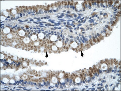 Anti-ZNF683 antibody produced in rabbit IgG fraction of antiserum