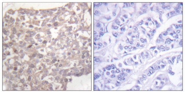 Anti-Tubulin &#947;, C-Terminal antibody produced in rabbit affinity isolated antibody