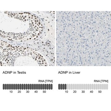 Anti-ADNP antibody produced in rabbit Prestige Antibodies&#174; Powered by Atlas Antibodies, affinity isolated antibody, buffered aqueous glycerol solution