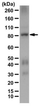 Anti-RSK4 Antibody from rabbit, purified by affinity chromatography