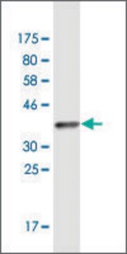 Monoclonal Anti-MOCS2 antibody produced in mouse clone 4H3, purified immunoglobulin, buffered aqueous solution