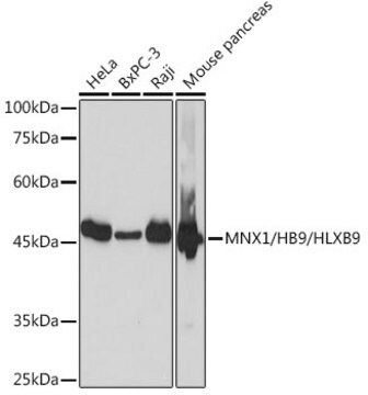 Anti-MNX1/HB9/HLXB9 Antibody, clone 9P1B7, Rabbit Monoclonal