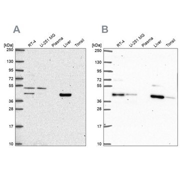 Anti-PHKG2 antibody produced in rabbit Prestige Antibodies&#174; Powered by Atlas Antibodies, affinity isolated antibody