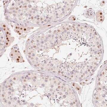 Anti-ARHGAP22 antibody produced in rabbit Prestige Antibodies&#174; Powered by Atlas Antibodies, affinity isolated antibody, buffered aqueous glycerol solution