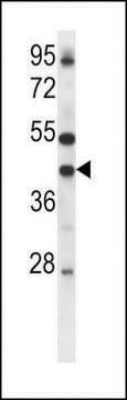 ANTI-CONNEXIN 37(C-TERMINAL) antibody produced in rabbit IgG fraction of antiserum, buffered aqueous solution