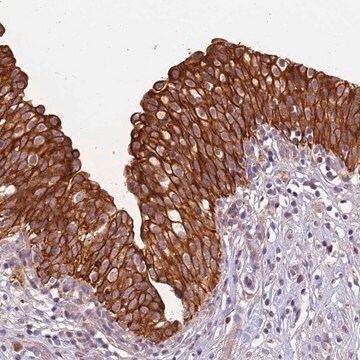 Anti-TIGAR antibody produced in rabbit Prestige Antibodies&#174; Powered by Atlas Antibodies, affinity isolated antibody, buffered aqueous glycerol solution