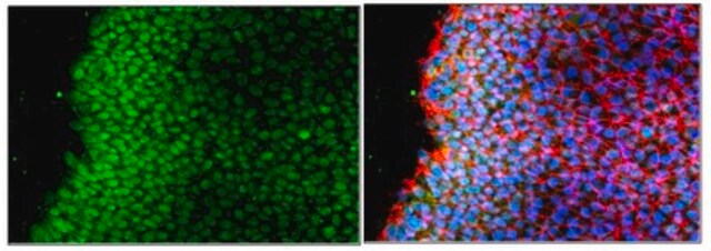 Anti-Rex-1 Antibody from rabbit, purified by affinity chromatography