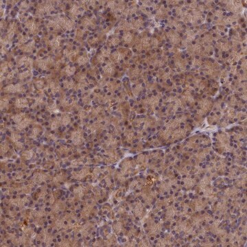 Anti-KIAA0100 antibody produced in rabbit Prestige Antibodies&#174; Powered by Atlas Antibodies, affinity isolated antibody, buffered aqueous glycerol solution