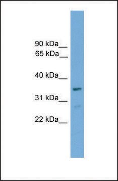 Anti-FOXI2, (C-terminal) antibody produced in rabbit affinity isolated antibody