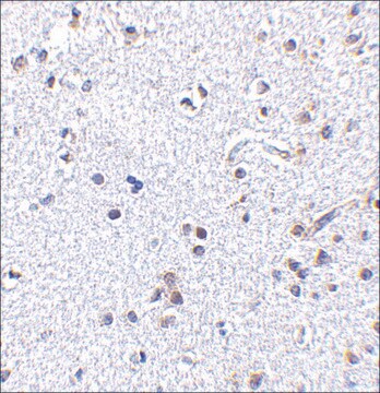 Anti-TSLP (ab1) antibody produced in rabbit affinity isolated antibody, buffered aqueous solution