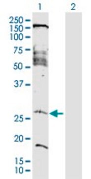 Anti-FAM177A1 antibody produced in rabbit purified immunoglobulin, buffered aqueous solution