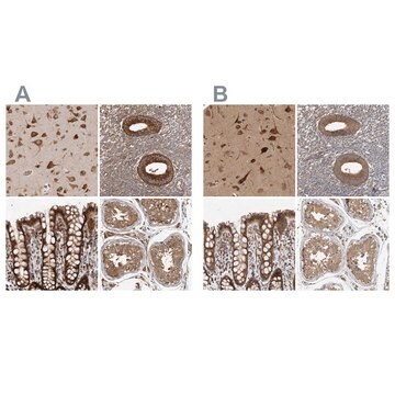 Anti-EIF3I antibody produced in rabbit Prestige Antibodies&#174; Powered by Atlas Antibodies, affinity isolated antibody, buffered aqueous glycerol solution, ab1