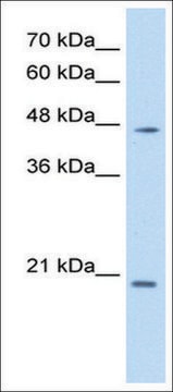 Anti-PAX6 (AB2) antibody produced in rabbit affinity isolated antibody