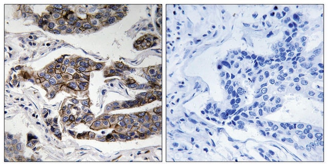 Anti-phospho-Girdin (pSer1417) antibody produced in rabbit affinity isolated antibody