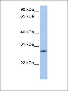 Anti-GSTM3 antibody produced in rabbit affinity isolated antibody