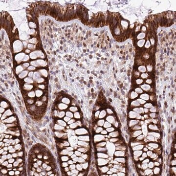 Anti-B3GNT9 antibody produced in rabbit Prestige Antibodies&#174; Powered by Atlas Antibodies, affinity isolated antibody, buffered aqueous glycerol solution