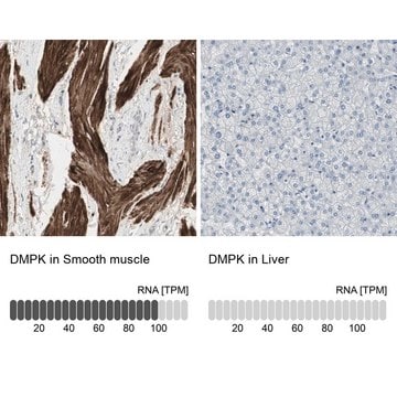 Anti-DMPK antibody produced in rabbit Ab1, Prestige Antibodies&#174; Powered by Atlas Antibodies, affinity isolated antibody, buffered aqueous glycerol solution