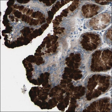 Anti-SLC27A1 antibody produced in rabbit Prestige Antibodies&#174; Powered by Atlas Antibodies, affinity isolated antibody, buffered aqueous glycerol solution