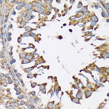 Anti-LysRS/KARS antibody produced in rabbit