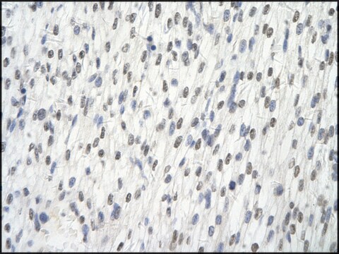 Anti-AARS antibody produced in rabbit affinity isolated antibody