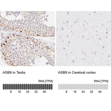 Anti-ASB9 antibody produced in rabbit Ab3, Prestige Antibodies&#174; Powered by Atlas Antibodies, affinity isolated antibody, buffered aqueous glycerol solution