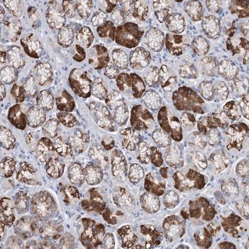 Anti-TRIM71 antibody produced in rabbit Prestige Antibodies&#174; Powered by Atlas Antibodies, affinity isolated antibody, buffered aqueous glycerol solution