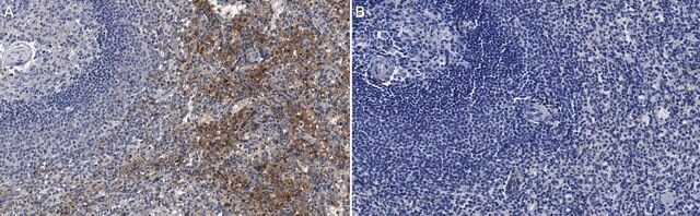 Anti-RANTES/CCL5 Antibody, clone 15B5.6