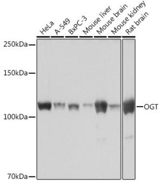 Anti-OGT antibody produced in rabbit