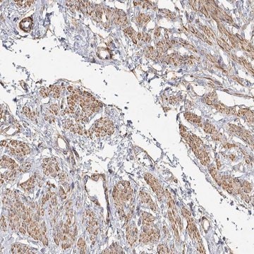 Anti-SOWAHD antibody produced in rabbit Prestige Antibodies&#174; Powered by Atlas Antibodies, affinity isolated antibody, buffered aqueous glycerol solution