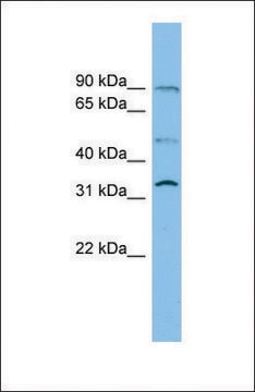 Anti-SLC27A3 antibody produced in rabbit affinity isolated antibody