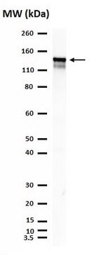 Anti-Phospho-STAT2(Tyr689)-Antikörper Upstate&#174;, from rabbit