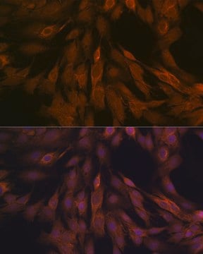 Anti-ULK3 Antibody, clone 5Z7Z6, Rabbit Monoclonal