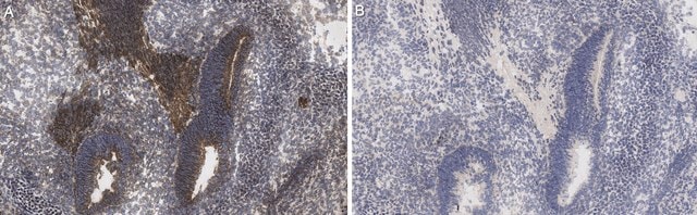 Anti-RTN/NOGO-A Antibody, clone NG1