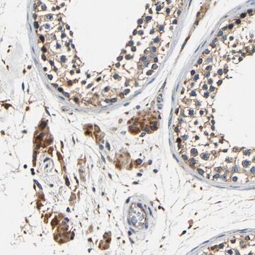 Anti-MTX1 antibody produced in rabbit Prestige Antibodies&#174; Powered by Atlas Antibodies, affinity isolated antibody, buffered aqueous glycerol solution