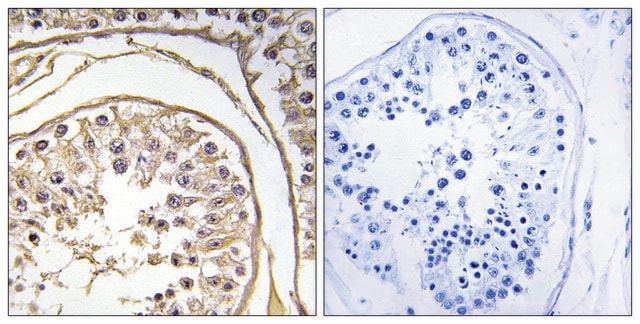 Anti-BAGE2 antibody produced in rabbit affinity isolated antibody