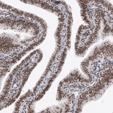 Monoclonal Anti-SMCHD1 antibody produced in mouse Prestige Antibodies&#174; Powered by Atlas Antibodies, clone CL4265, purified immunoglobulin