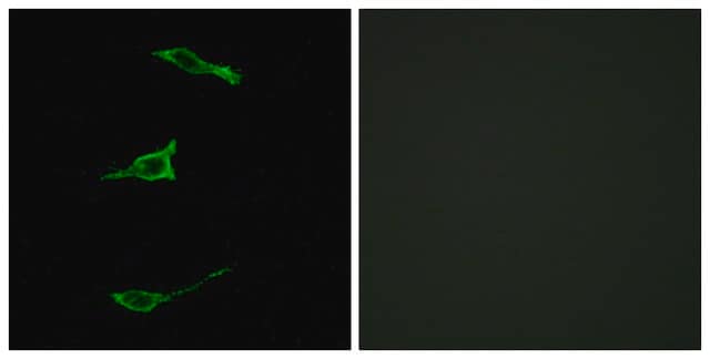 Anti-FFAR1 antibody produced in rabbit affinity isolated antibody