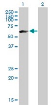 Anti-IGHM antibody produced in mouse purified immunoglobulin, buffered aqueous solution