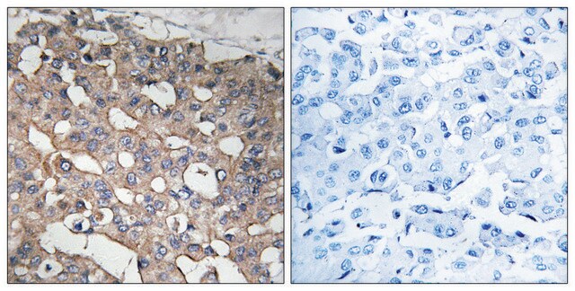 Anti-STMN1 antibody produced in rabbit affinity isolated antibody