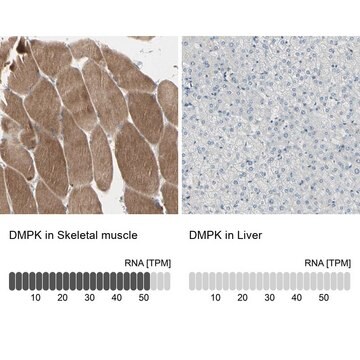 Anti-DMPK antibody produced in rabbit Prestige Antibodies&#174; Powered by Atlas Antibodies, affinity isolated antibody, buffered aqueous glycerol solution