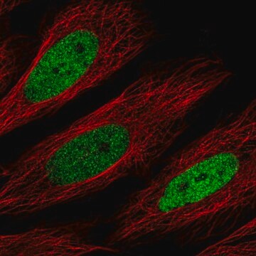 Anti-CEBPD antibody produced in rabbit Prestige Antibodies&#174; Powered by Atlas Antibodies, affinity isolated antibody