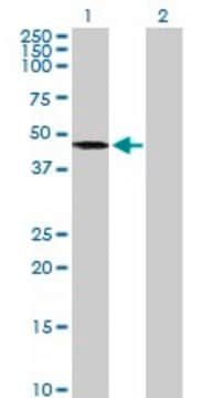 Anti-AGK antibody produced in mouse purified immunoglobulin, buffered aqueous solution