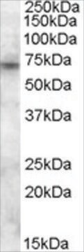 Anti-ABCD3 antibody produced in goat affinity isolated antibody, buffered aqueous solution