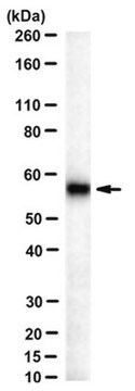 Anti-3-PGDH Antibody, clone TK-08 13A8 clone TK-08 13A8, from mouse