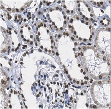 Anti-Polyhomeotic-like protein 2 Antibody (PHC2) from rabbit, purified by affinity chromatography