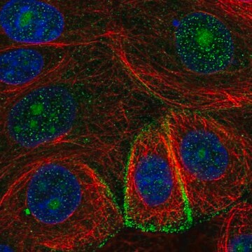 Anti-GDE1 antibody produced in rabbit Prestige Antibodies&#174; Powered by Atlas Antibodies, affinity isolated antibody